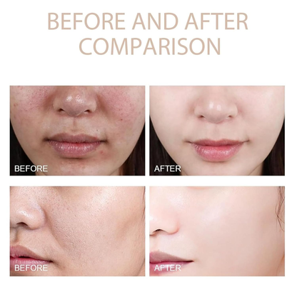 Gentle Exfoliating Gel